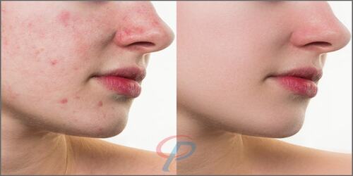 Photo Retouching