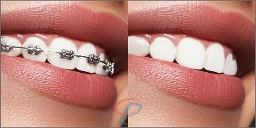 Photo Retouching