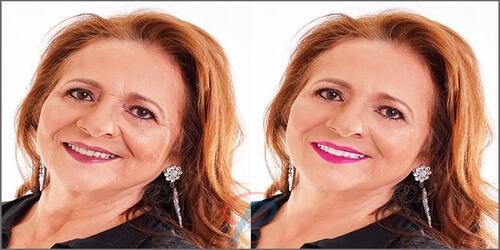 Image Enhancement
