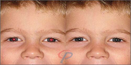 Photo Retouching
