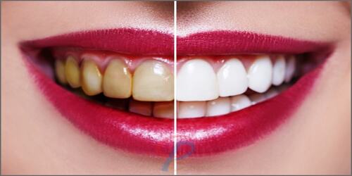 Photo Retouching