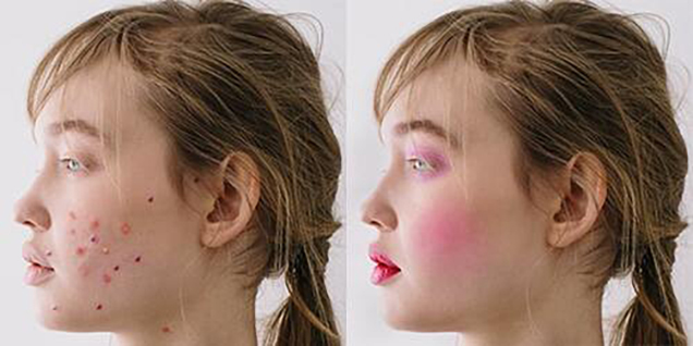 Image Editing